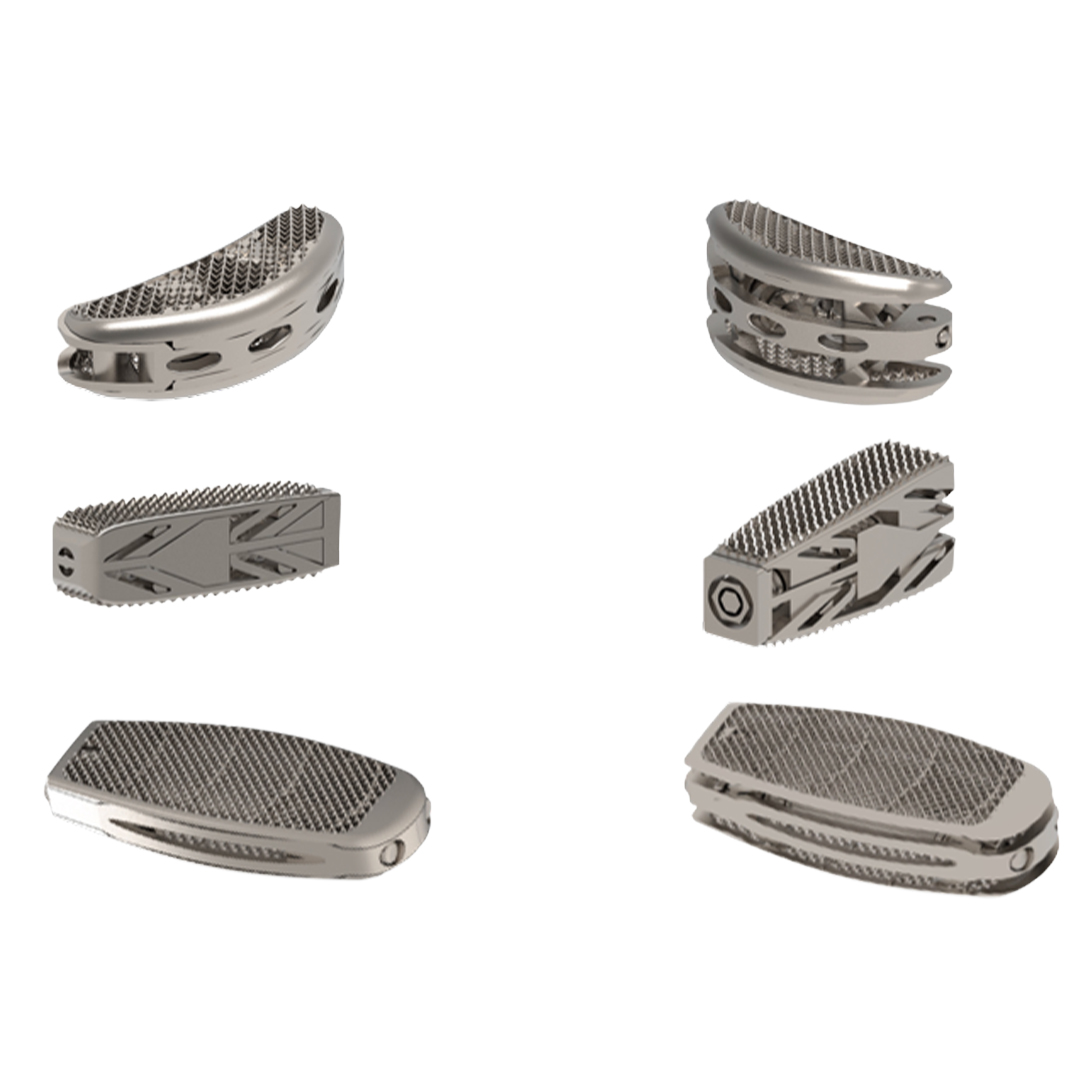 3D Printed Expandable Interbody Cages