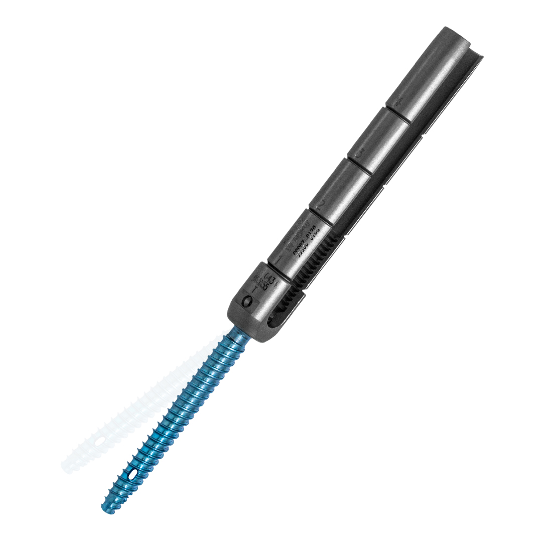 MIS Spine Fracture Fixation