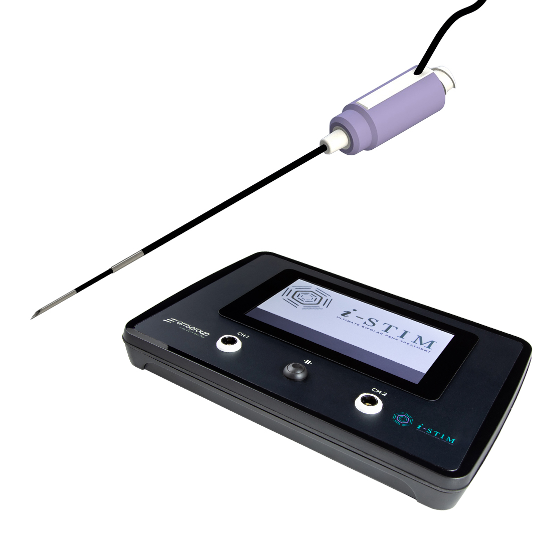 Percutaneous Electrical Nerve Stimulation – PENS – for pain modulation
